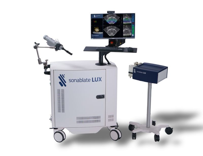 High-Intensity Focused Ultrasound (HIFU)